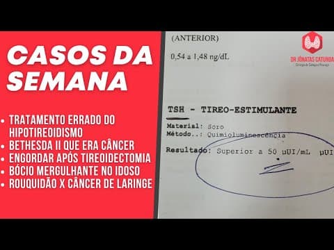 Casos da semana - Hipotireoidismo, Bócio mergulhante, Bethesda II maligno, Peso X TT,