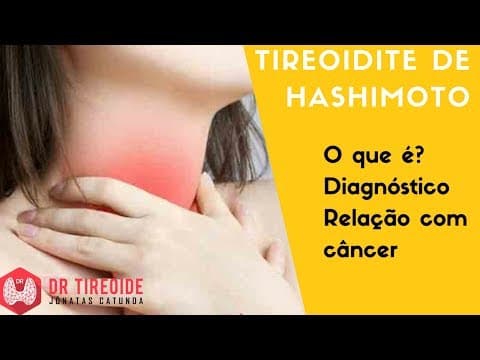 Tireoidite de Hashimoto e o Hipotireoidismo | Dr Jônatas Catunda