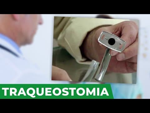 Traqueostomia no câncer de cabeça e pescoço