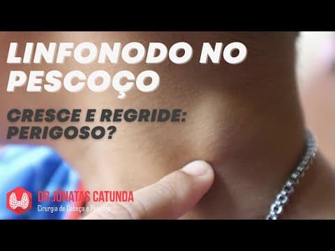 Linfonodo aumentado no pescoço, também chamado de íngua no pescoço