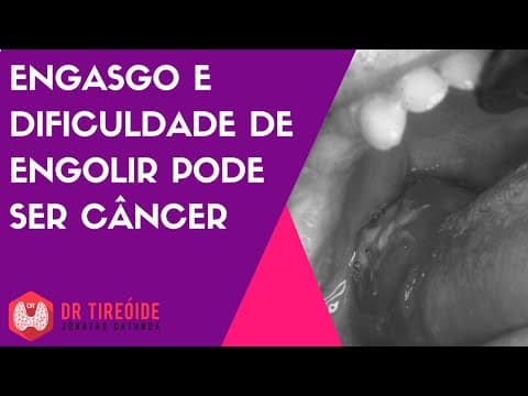 Engasgo e dificuldade de engolir podem ser sintomas do câncer!