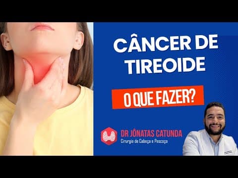 Câncer de tireoide na punção: o que fazer?