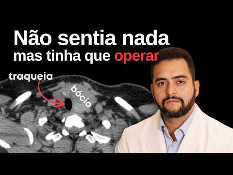 Não sentia nada, mas tinha que operar