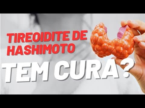 Tireoidite de Hashimoto tem cura?