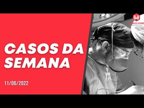 Casos da semana - câncer de tireoide, linfoma, câncer de pele, ablação por radiofrequência, toetva