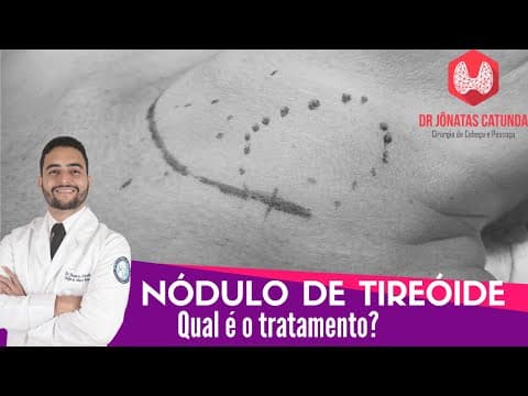 Como é feito o tratamento dos nódulos na tireoide?