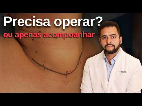 Nódulo na tireoide: quando é hora de operar?