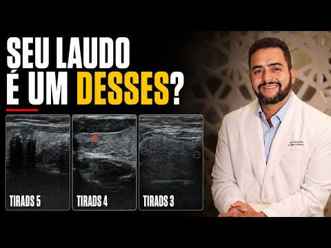 Qual TI-RADS é perigoso? Veja os nódulos que preocupam no ultrassom