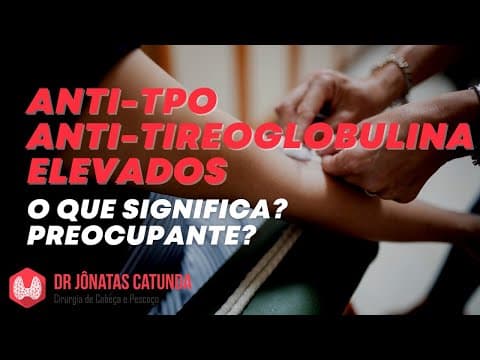 Anti-TPO e Anti-Tireoglobulina elevados: Tireoidite de Hashimoto