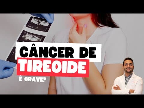 Câncer de tireoide é grave? Dr Jônatas Catunda Cirurgião de cabeça e pescoço