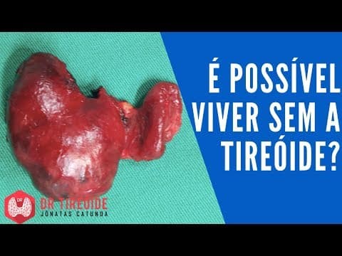 É possível viver sem a tireóide? - Dr Tireóide Responde
