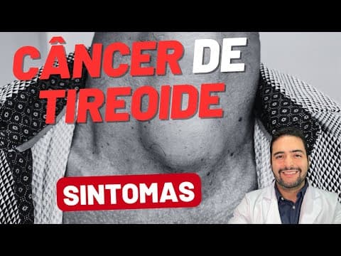 Câncer de Tireoide: Sintomas Que Você Precisa Conhecer!