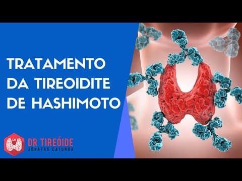 Tratamento da Tireoidite de Hashimoto - Perguntas e Respostas - Dr Tireóide responde