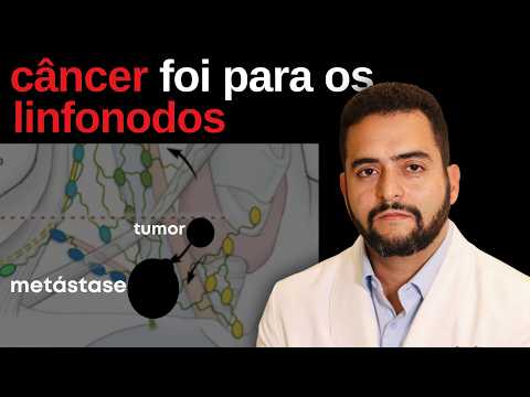 Metástase linfonodal no câncer de tireoide: é grave? Tem cura?