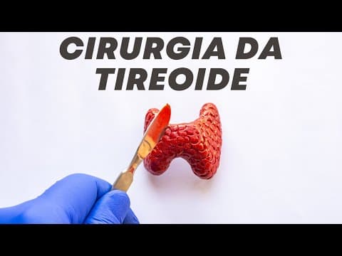 O que muda após a cirurgia da tireoide? - Live respondendo perguntas