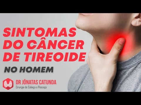 Sintomas do câncer de tireoide no homem