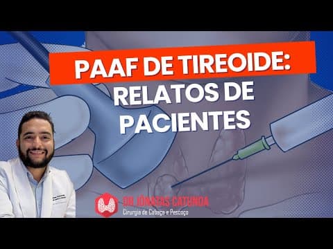 PAAF - punção de nódulo na tireoide - Comentando os comentários do instagram