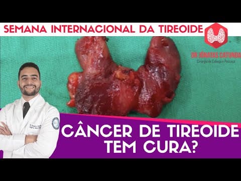 Câncer tireoide tem cura? - Semana internacional da tireoide