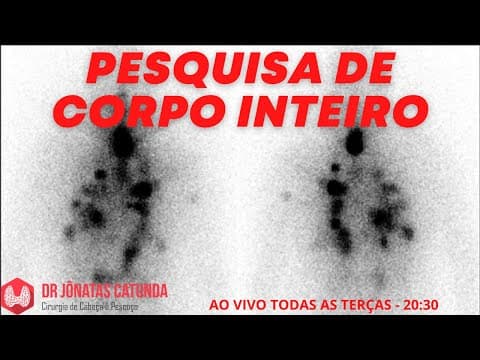Pesquisa de corpo inteiro - PCI, iodoterapia, câncer de tireoide