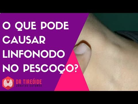 O que pode causar linfonodo no pescoço? - Dr Jônatas Catunda