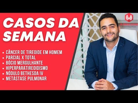 Casos da semana - Câncer de tireoide em homens, Adenoma de paratireóide, bócio em idosos