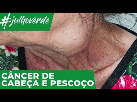 O que é o câncer de cabeça e pescoço? | Campanha Julho Verde