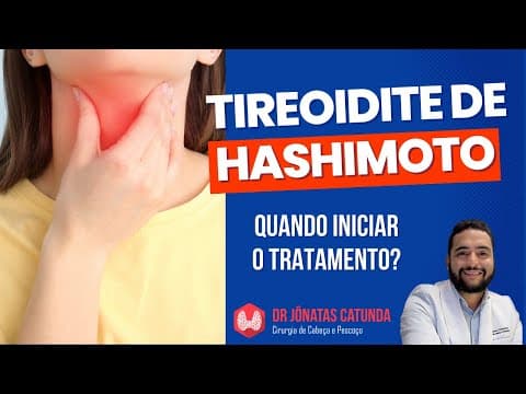 Tireoidite de Hashimoto: Quando iniciar o tratamento?