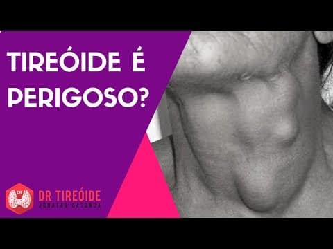 Tireóide é perigoso? | Dr Jônatas Catunda