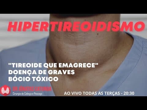 Hipertireoidismo - Ao vivo tirando dúvidas