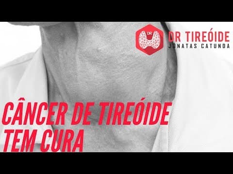 Câncer de tireóide tem cura? - O que todo mundo deveria saber! | Dr Jônatas Catunda