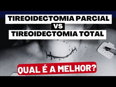 Tireoidectomia Total ou Parcial? Descubra Qual a Melhor Opção para o Seu Caso?