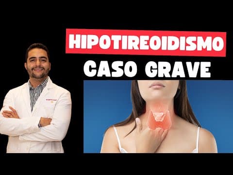 Hipotireoidismo grave - sintomas, exames, tratamento
