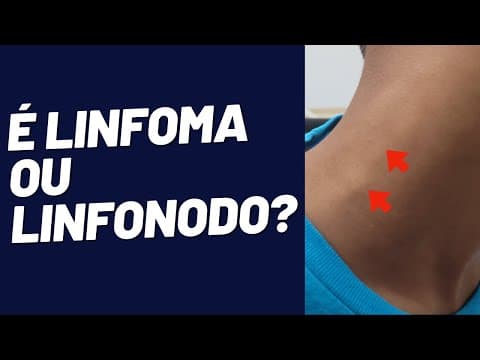 Linfonodo no pescoço: É um linfoma ou algo benigno?
