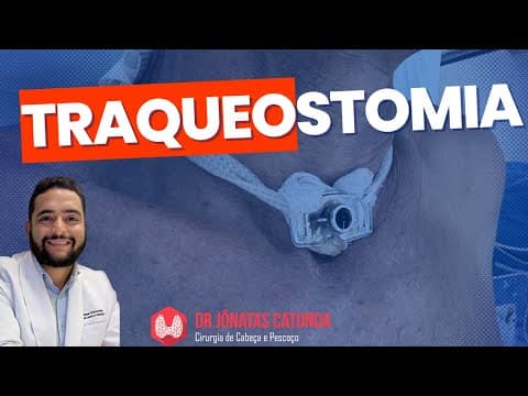 Traqueostomia - indicações, riscos, complicações