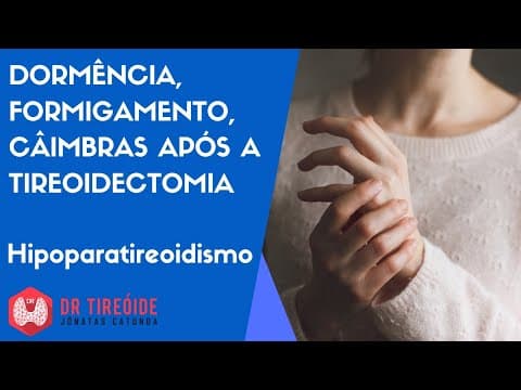 Dormência, Formigamento, Câimbra após a tireoidectomia - Dr Tireóide responde