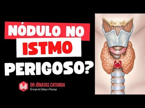 Nódulo no istmo da tireoide é perigoso?