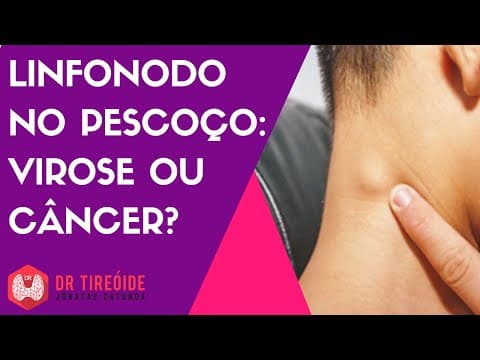 Linfonodo do pescoço - Virose ou câncer?