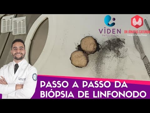 Como é feita a biopsia de linfonodo - processamento do material pelo laboratório