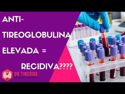 Anti-tireoglobulina elevada pode ser recidiva?
