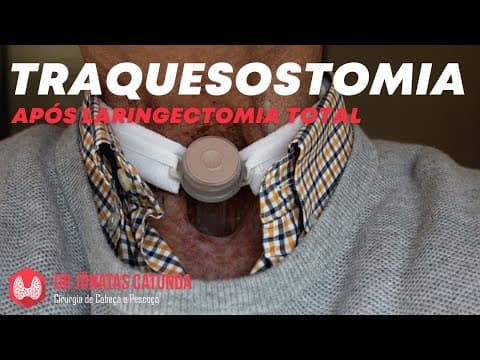 Traqueostomia X Laringectomia total