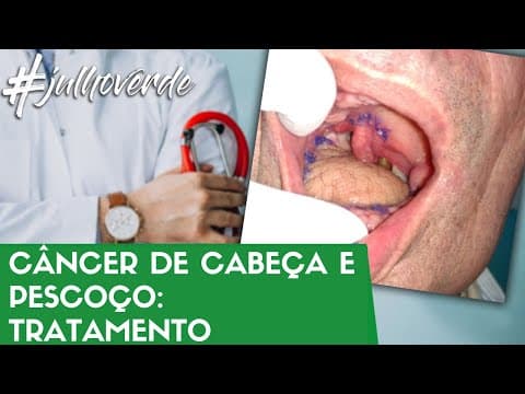 Tratamento do câncer de cabeça e pescoço - Radioterapia? Quimioterapia? | Campanha Julho Verde