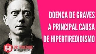 Doença de Graves, a causa mais comum de Hipertireoidismo | Dr Jônatas Catunda