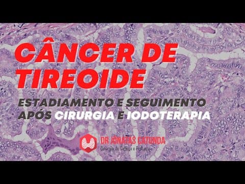 Câncer de tireoide: estadiamento, seguimento e como detectar metástases