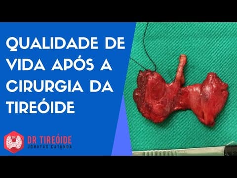 Qualidade de vida após a cirurgia da tireóide