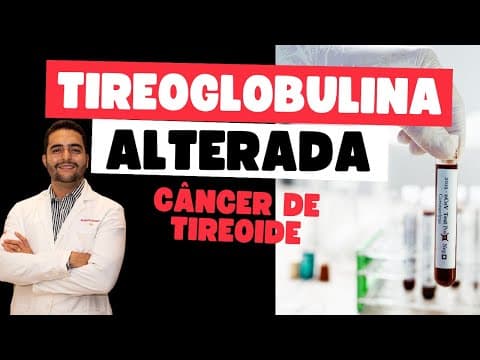 Recidiva do câncer de tireoide? Tireoglobulina subindo pode ser preocupante