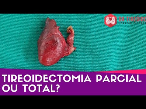 Tireoidectomia parcial ou total? - Dr Tireóide responde