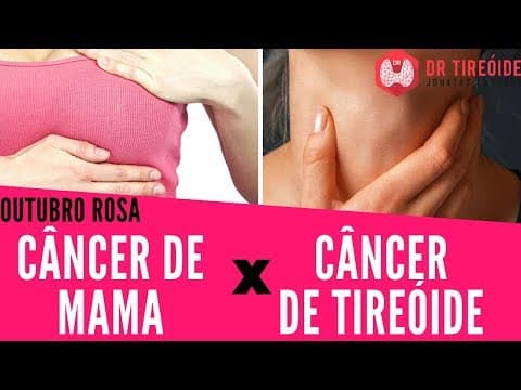 Câncer de mama tem relação com câncer de tireóide? Especial Outubro rosa#65