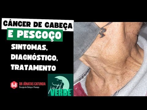 Câncer de cabeça e pescoço - Julho verde