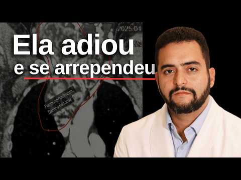 Ela adiou a cirurgia e se arrependeu: o bócio virou mergulhante | Dr. Jônatas Catunda
