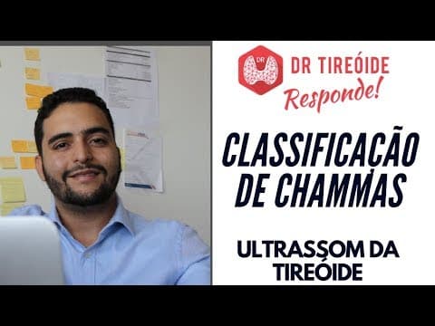 Classificação de Chammas: por que eu não confio